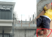 Tragedi di STIT Pemalang: Kesetrum Saat Bekerja, Pria Ini Harus Kehilangan Jari Kaki dan Tangan