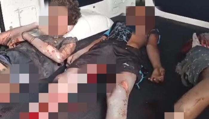 Tiga Bocah di Cilacap Luka Parah Usai Ledakan Petasan