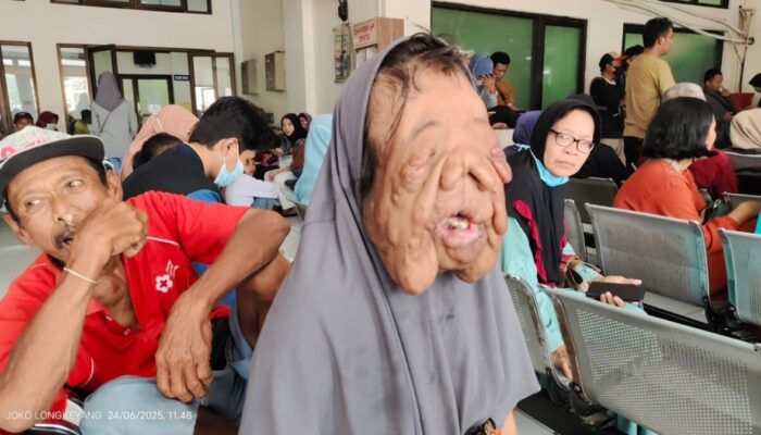 Wajah yang Berakar, Hati yang Tegar: Kisah Kholipah dari Pemalang